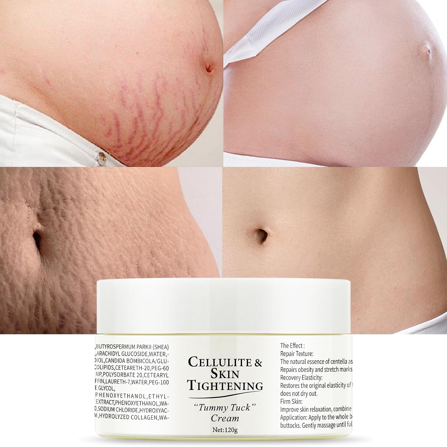 Stretch Marks Removal Cream for Pregnancy,Mama Belly Butter 4.23oz